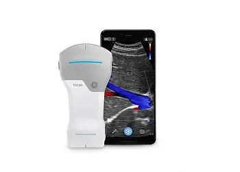 УЗИ аппарат GE HealthCare Vscan Air карманный