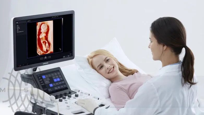Samsung Medison HS40 УЗИ аппарат