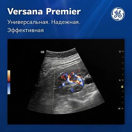 Клинические изображения Versana Premier Black GE Healthcare