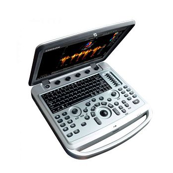 УЗИ аппарат Chison SonoBook 6