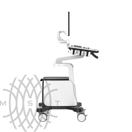 УЗИ аппарат Chison Qbit 5