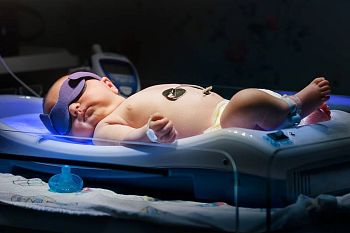 Philips WeeSpecs Маска защитные для фототерапии новорожденных