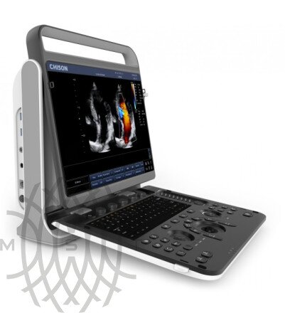 УЗИ аппарат Chison SonoTouch 60 портативный